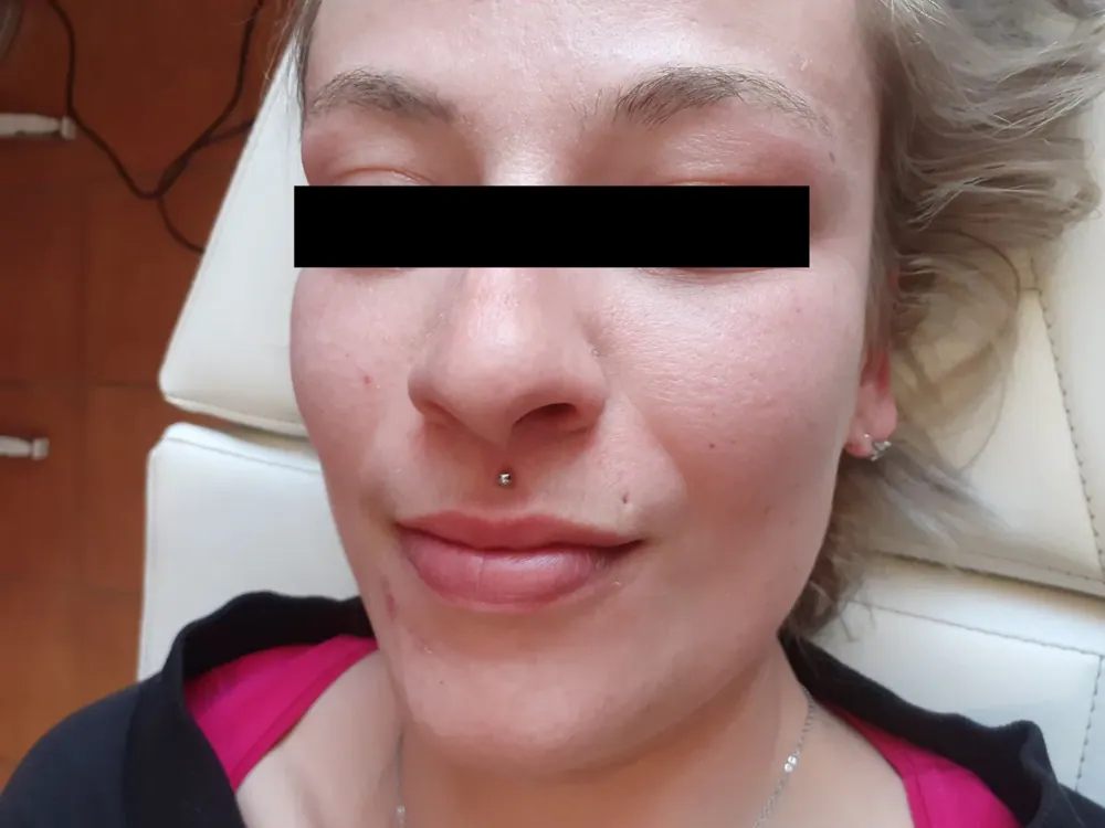 Piercing aplikovaný v štúdiu MIA art TATTOO