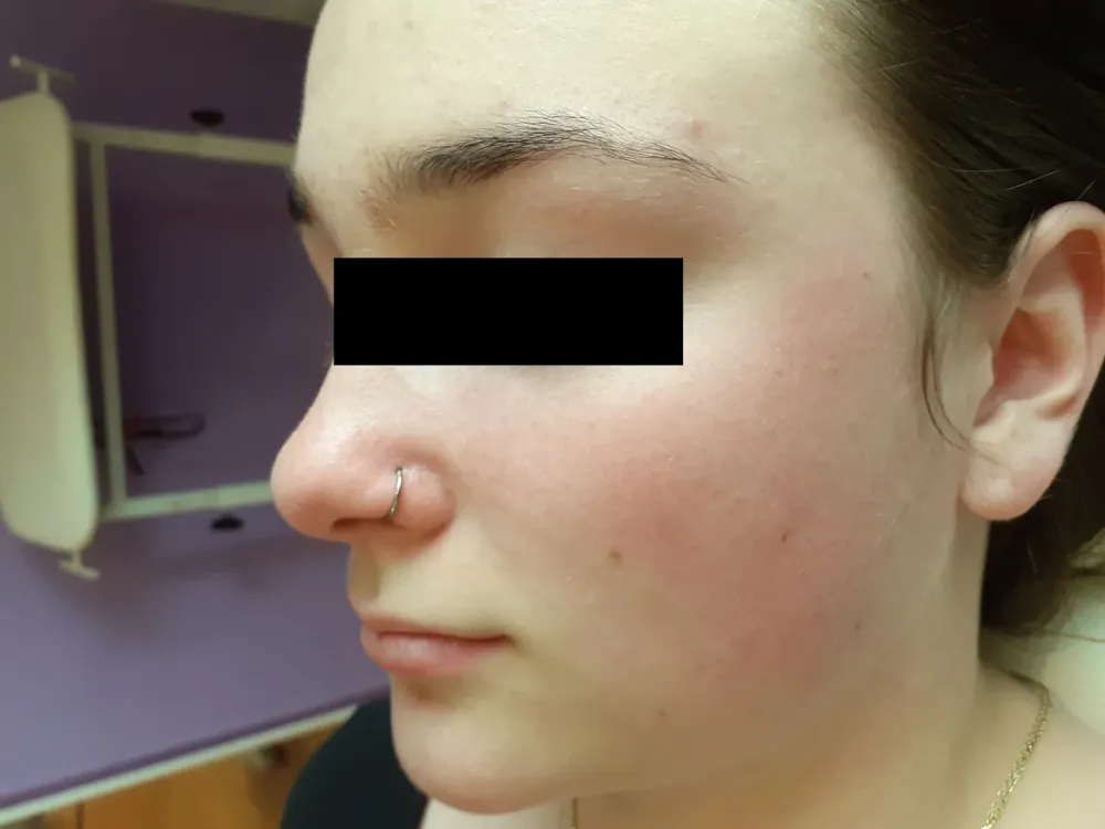 Piercing aplikovaný v štúdiu MIA art TATTOO