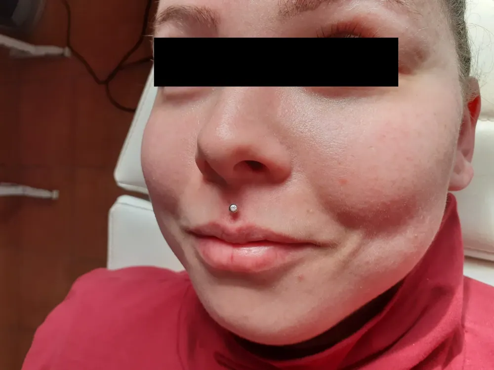 Piercing aplikovaný v štúdiu MIA art TATTOO