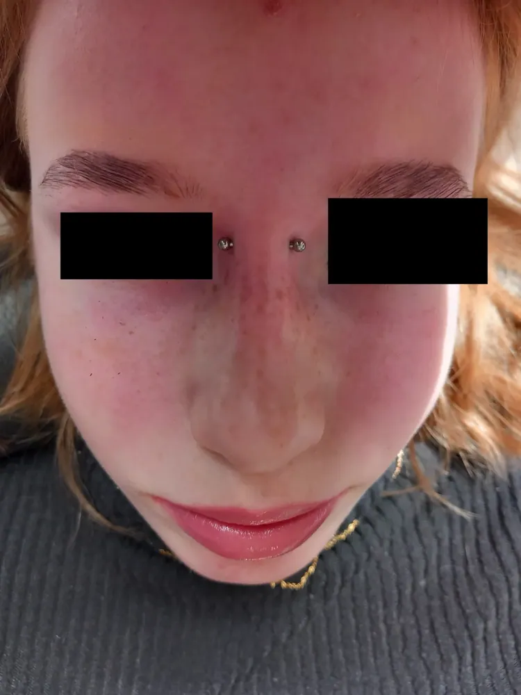 Piercing aplikovaný v štúdiu MIA art TATTOO