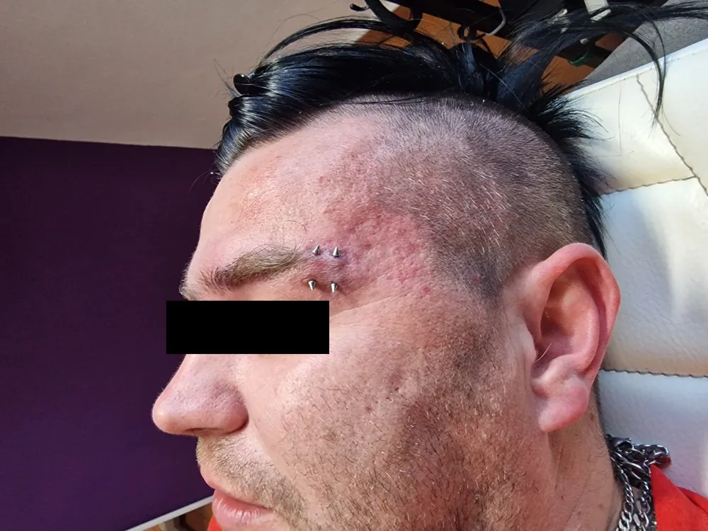 Piercing aplikovaný v štúdiu MIA art TATTOO