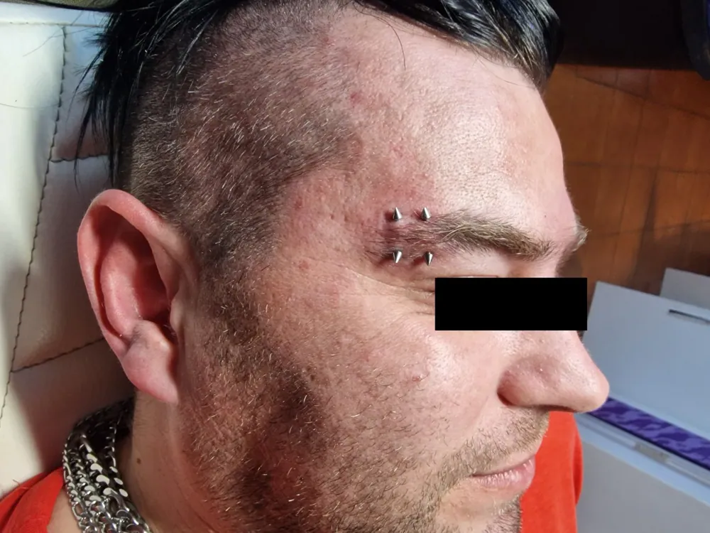 Piercing aplikovaný v štúdiu MIA art TATTOO