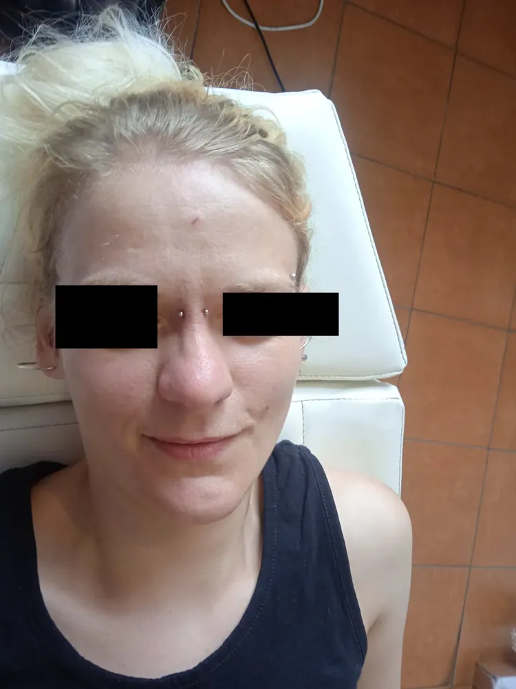 Piercing aplikovaný v štúdiu MIA art TATTOO