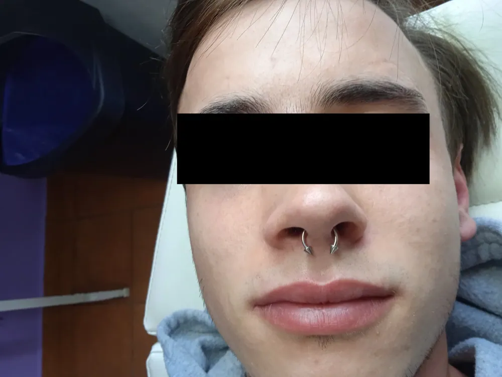 Piercing aplikovaný v štúdiu MIA art TATTOO